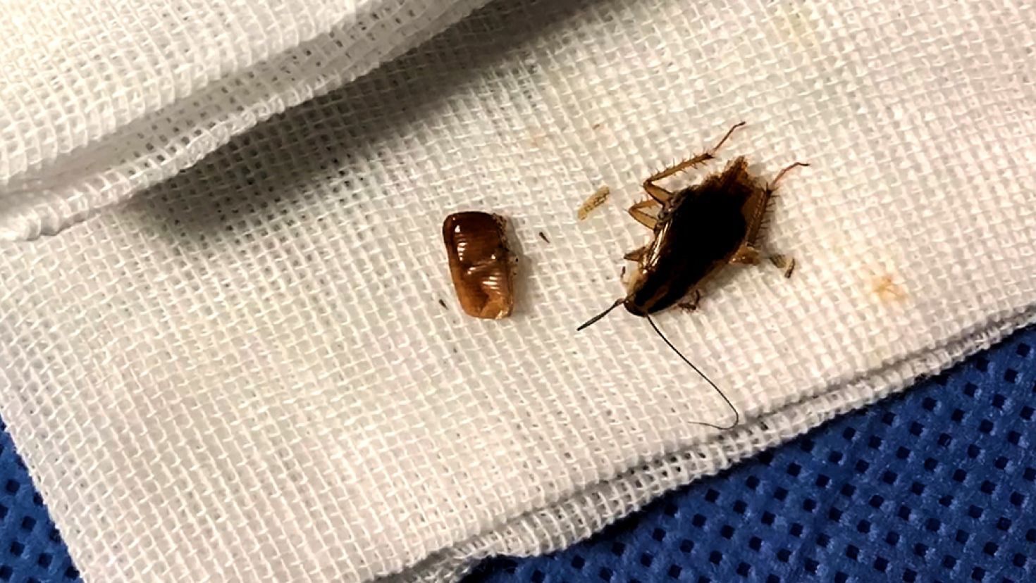 Group Of Cockroaches Discovered Living Inside Man’s Ear
